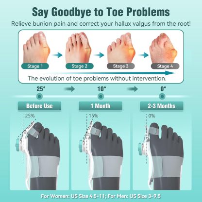 Adjustable knob hallux valgus corrector