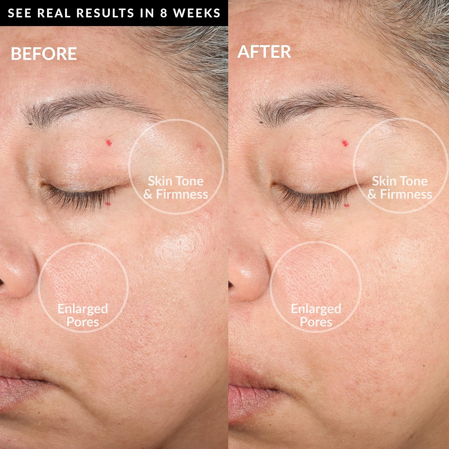 Smart Facial Cleansing Device – Blackhead Reduction