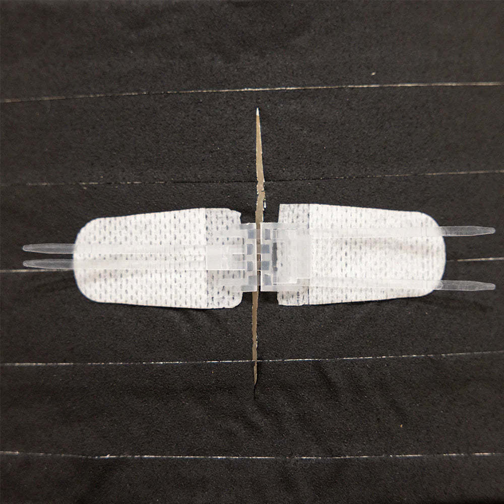 Wound Closure Kit – Non-Invasive, Pain-Free Emergency Care