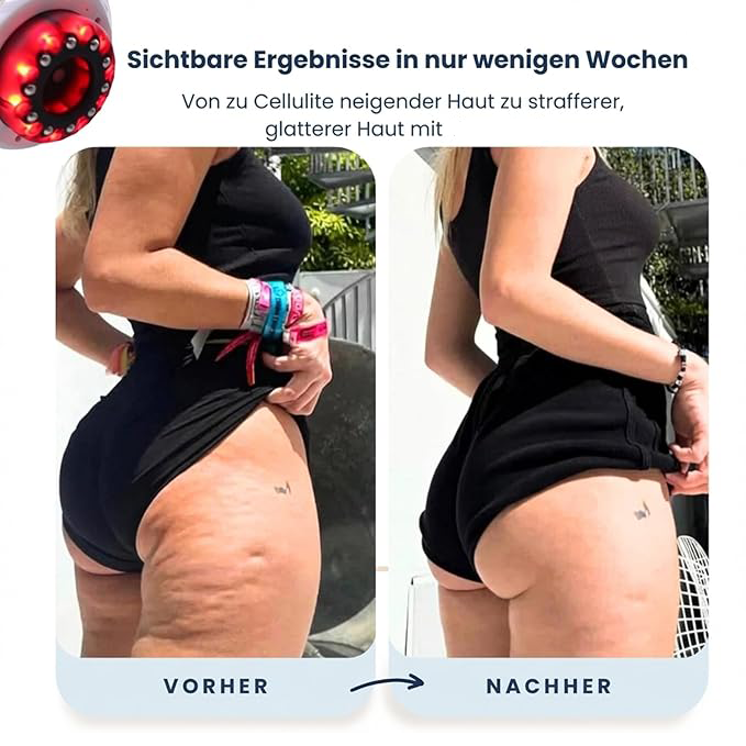 4-in-1 Slimming Massager