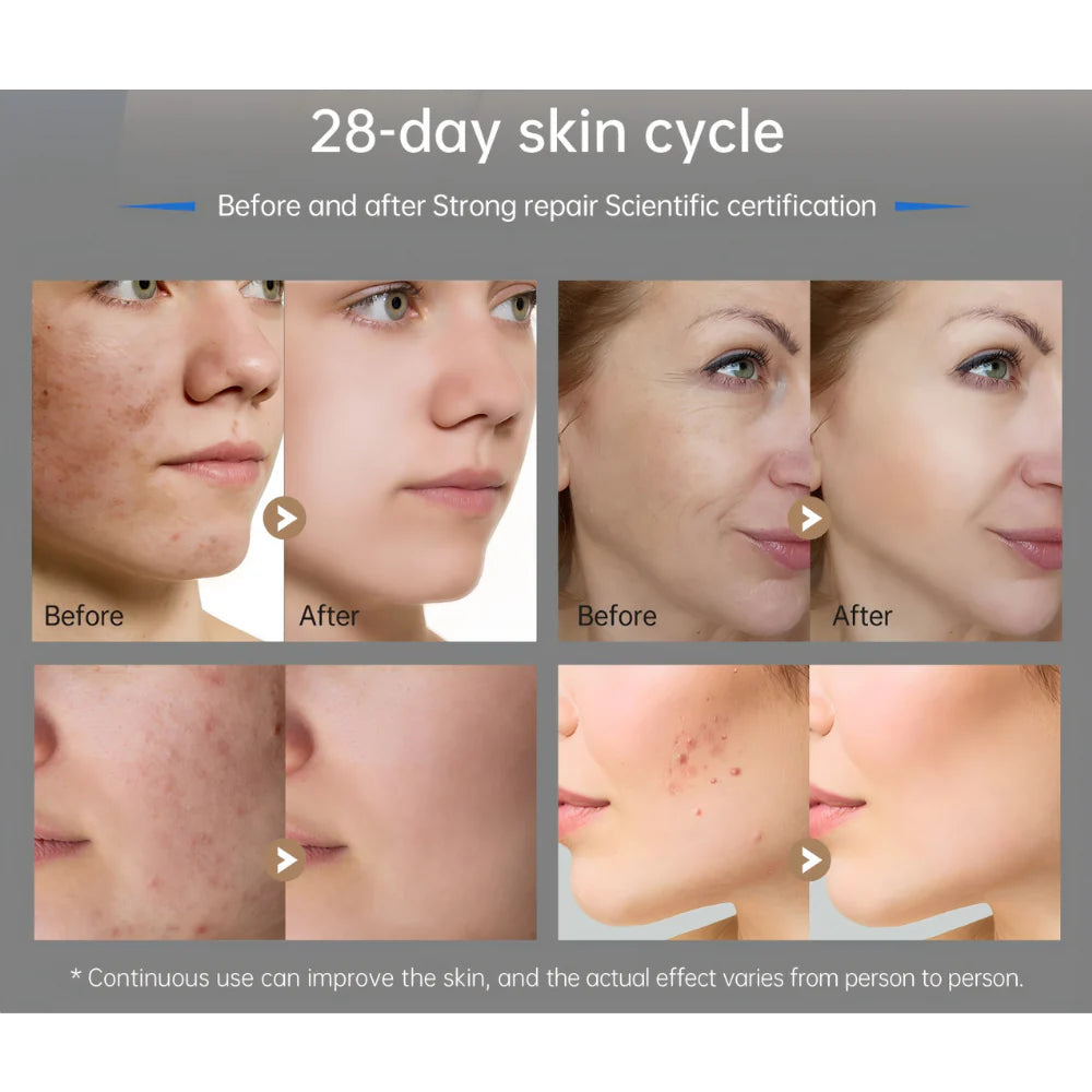 Microneedling Pen – Smart Needle Adjustment