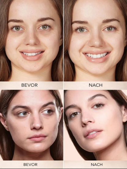 【Risikofrei Testen】Farbkorrigierender CC Ton-Concealer | Gegen Augenringe + Falten| Squalan + Koffein Pflege | Gratis Pinsel💖