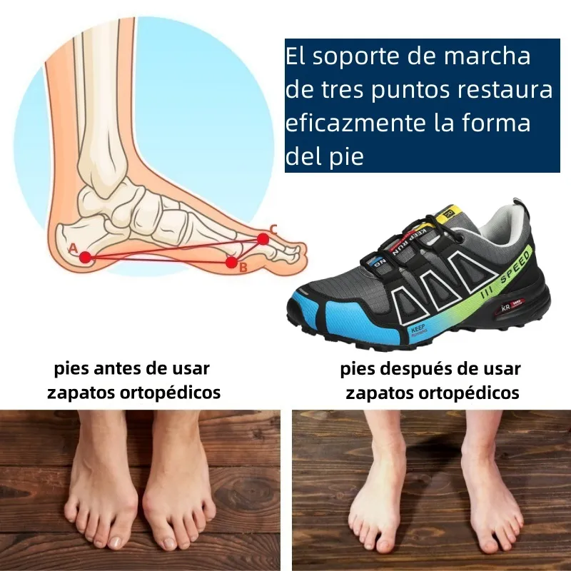 🔥¡Último día con un 30% de descuento! ¡No te lo pierdas!⏰ Zapatos ortopédicos de diseño ergonómico para aliviar el dolor de espalda, articulaciones y pies - unisex