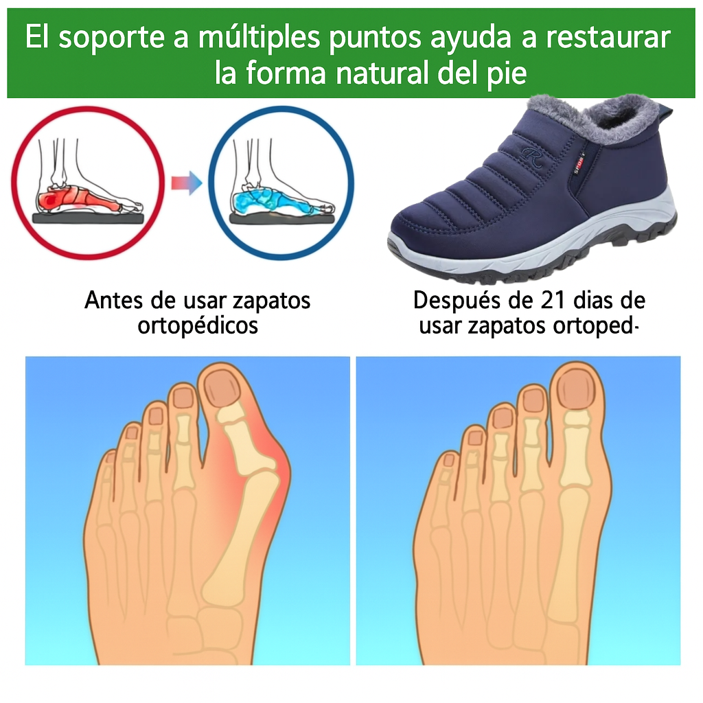 🔥Oferta por tiempo limitado, ¡disfruta de un 30% de descuento!⏰ Zapatos ortopédicos de una marca australiana de lujo: zapatos ortopédicos para caminar cálidos, duraderos e impermeables🦶 con soporte elástico para el tobillo.