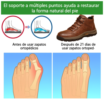 🐂 Zapatos de piel de becerro para hombre, cosidos a mano en Australia 👞 Alivio inteligente del dolor impulsado por IA, fácil de poner y quitar ✅ Correctivo integral: impermeable y antideslizante