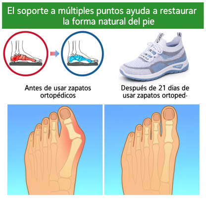 【🎁Oferta por tiempo limitado】Zapatos casuales ergonómicos para mujer👞 - El soporte para el arco proporciona comodidad y alivia fácilmente el dolor de pies🦶