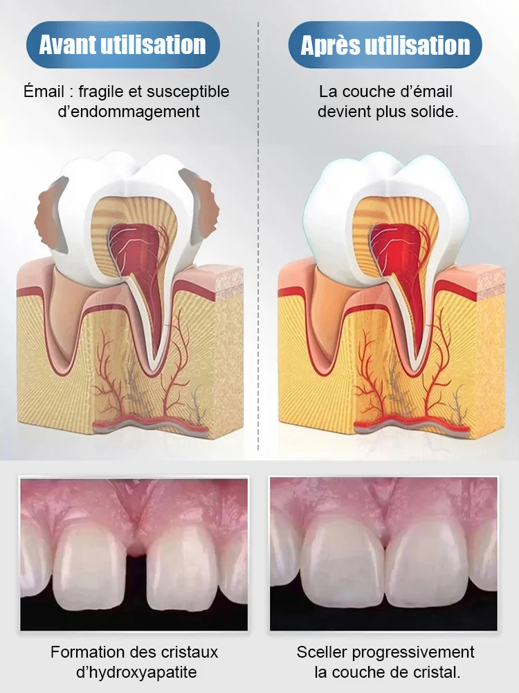 【Recommandé par des dentistes renommés】Gouttes protectrices pour dents à base d'hydroxyapatite