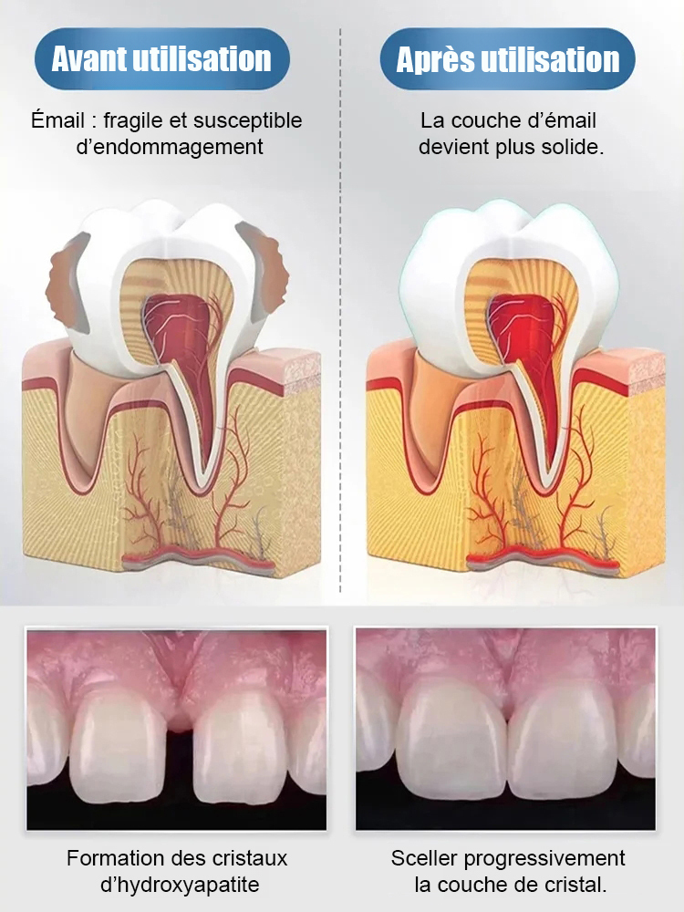 【Recommandé par des dentistes renommés】Gouttes protectrices pour dents à base d'hydroxyapatite