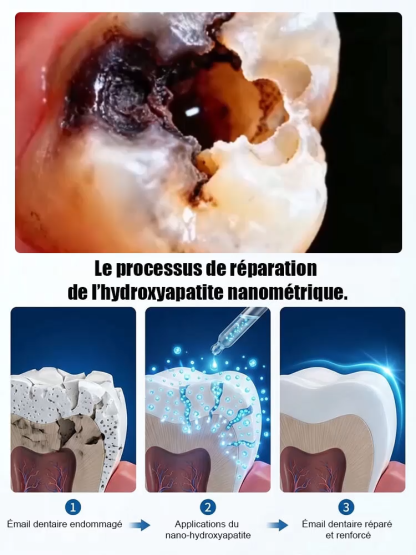 【Recommandé par des dentistes renommés】Gouttes protectrices pour dents à base d'hydroxyapatite