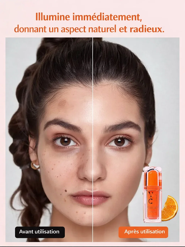 Crème Hydratante Illuminatrice à la Vitamine C 5-en-1, Troisième Génération