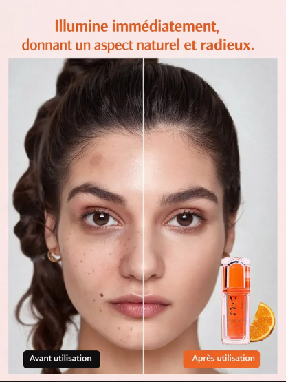 Crème Hydratante Illuminatrice à la Vitamine C 5-en-1, Troisième Génération