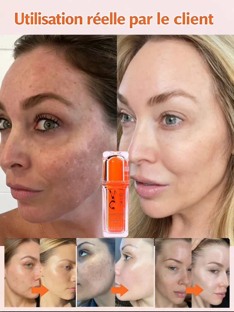 Crème Hydratante Illuminatrice à la Vitamine C 5-en-1, Troisième Génération