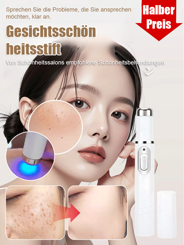 Laser schmerzfreier Warzenentferner-Stift