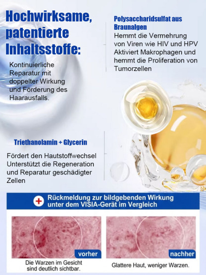 🔥 Schmerzlose Warzen-weg Salbe – Sofort wirksam
