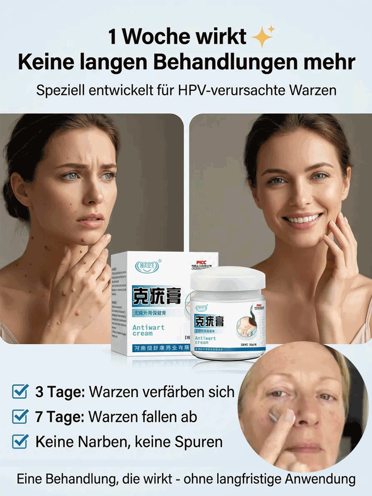 🔥 Schmerzlose Warzen-weg Salbe – Sofort wirksam