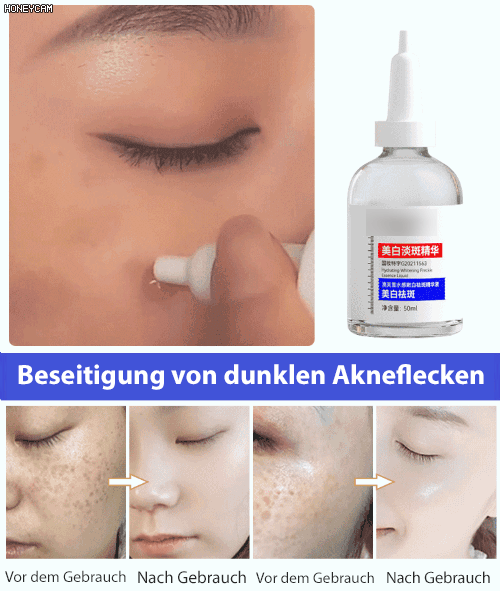 Aufhellendes Serum gegen Hautunreinheiten