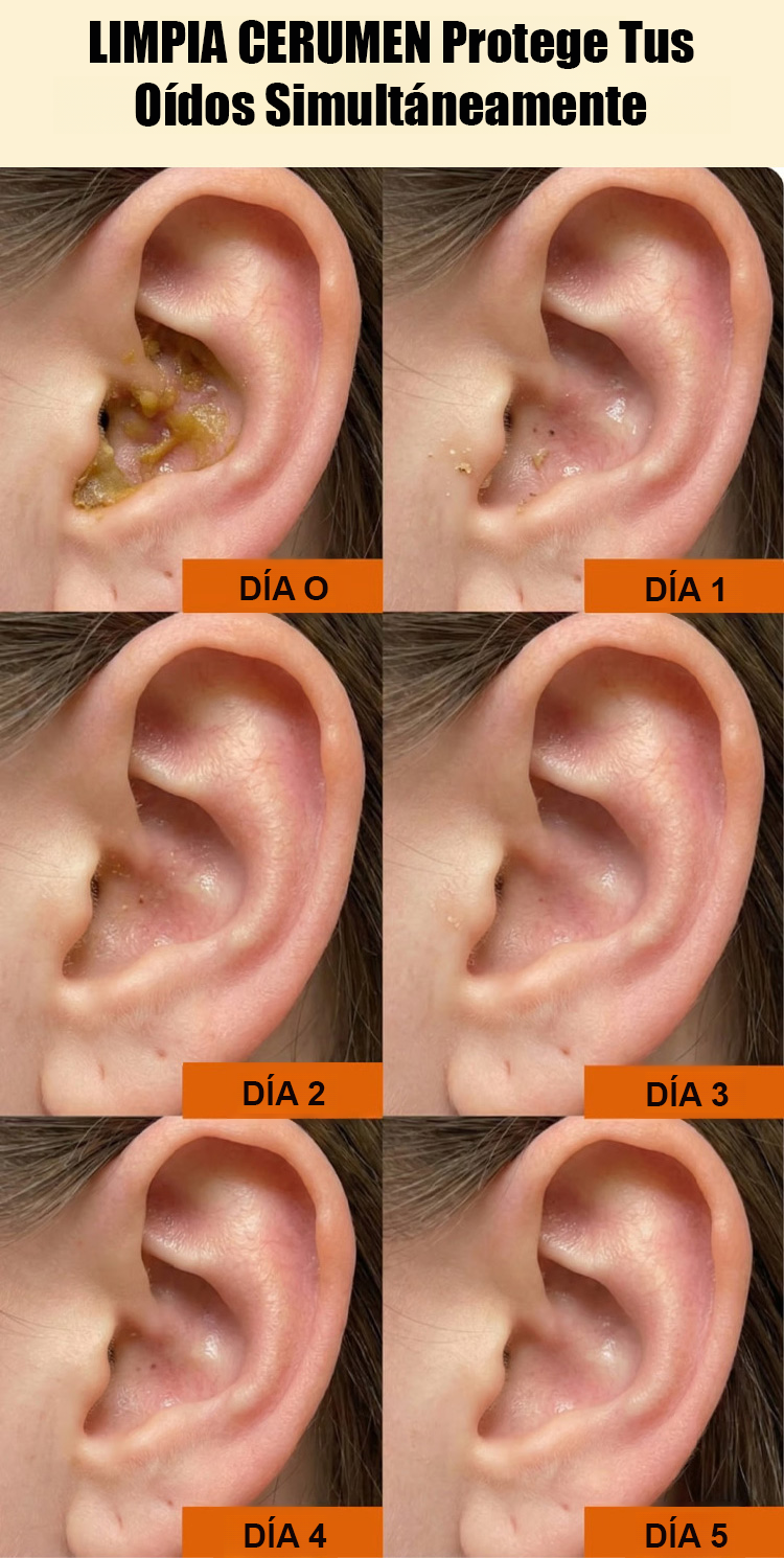 翻译件-便携电动洁耳器套装-1355308-系统_08.png