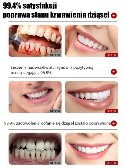 🌿Polecane przez dentystów: Zdrowa mikroflora jamy ustnej.