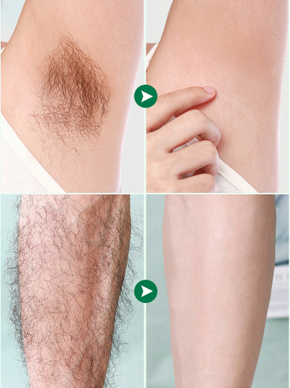 ✨5 minut bezbolesnego, trwałego usuwania owłosienia, żegnaj krępujące, szorstkie włosy✨