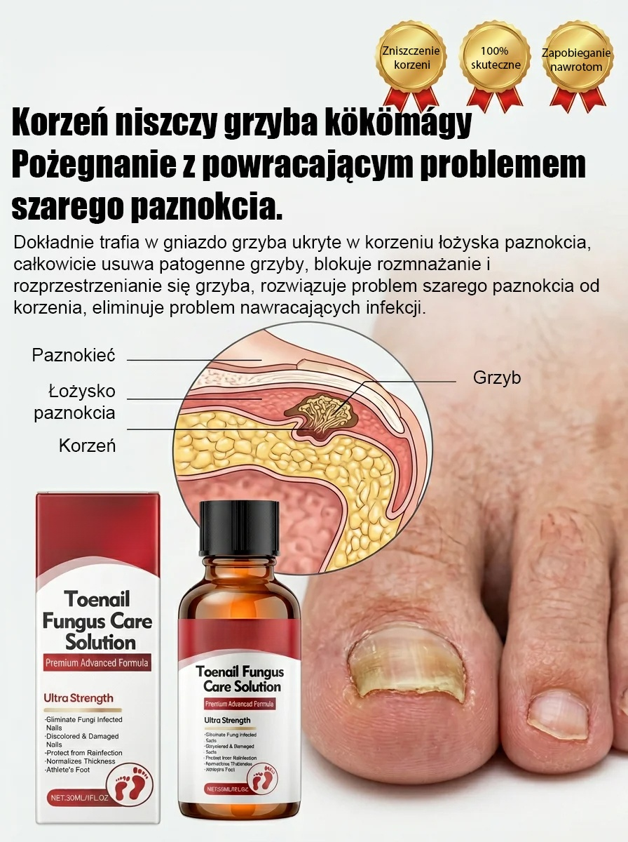 100% bezbolesne krople: bez potrzeby usuwania paznokci, szlifowania czy bandażowania – już w 14 dni odzyskasz zdrowe, nowe paznokcie!