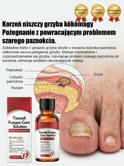 100% bezbolesne krople: bez potrzeby usuwania paznokci, szlifowania czy bandażowania – już w 14 dni odzyskasz zdrowe, nowe paznokcie!