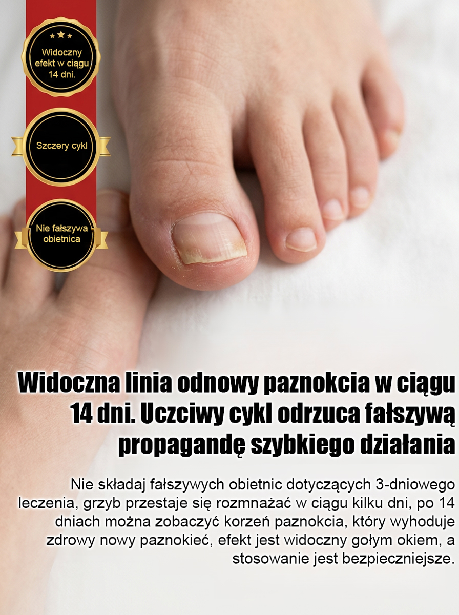 100% bezbolesne krople: bez potrzeby usuwania paznokci, szlifowania czy bandażowania – już w 14 dni odzyskasz zdrowe, nowe paznokcie!