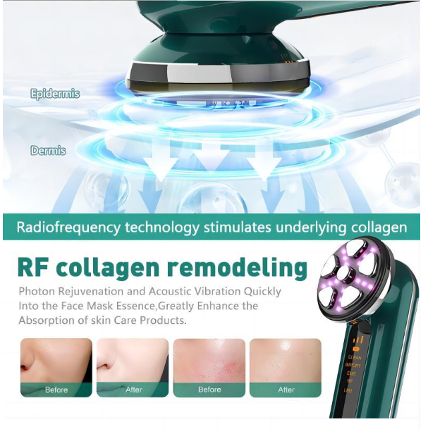 RF Device with Microcurrent, Face Lifting & Tightening Machine for Wrinkles, At-Home Facial Massager & Toner-Lumenessence