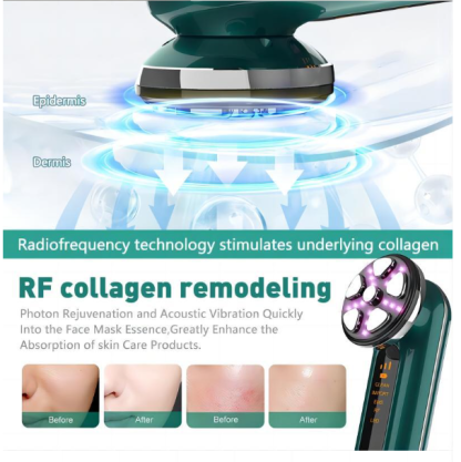 RF Device with Microcurrent, Face Lifting & Tightening Machine for Wrinkles, At-Home Facial Massager & Toner-Lumenessence