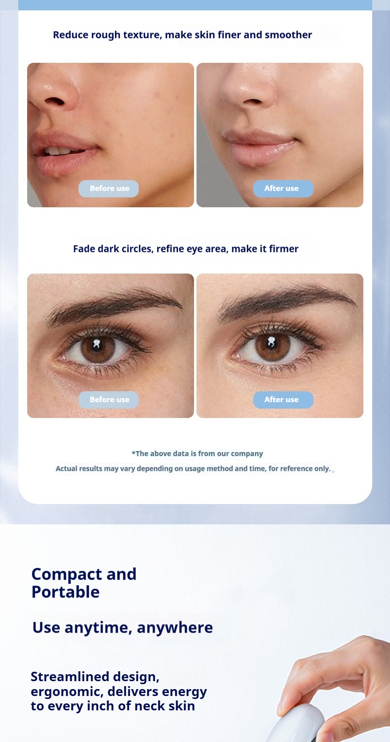 V-Line Shaping Device - Professional Facial Lifting Roller with EMS & LED Light Therapy for a Tighter, Youthful Look-Lumenessence