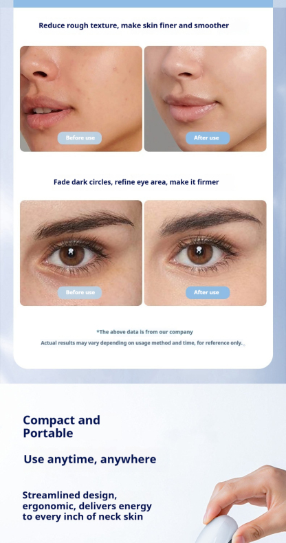 V-Line Shaping Device - Professional Facial Lifting Roller with EMS & LED Light Therapy for a Tighter, Youthful Look-Lumenessence