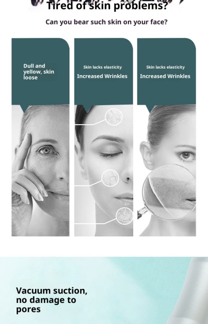 Professional Pore Vacuum: Blackhead & Comedone Extractor Machine for Deep Cleaning Facial Spa | Salon-Grade Suction Tool-Lumenessence