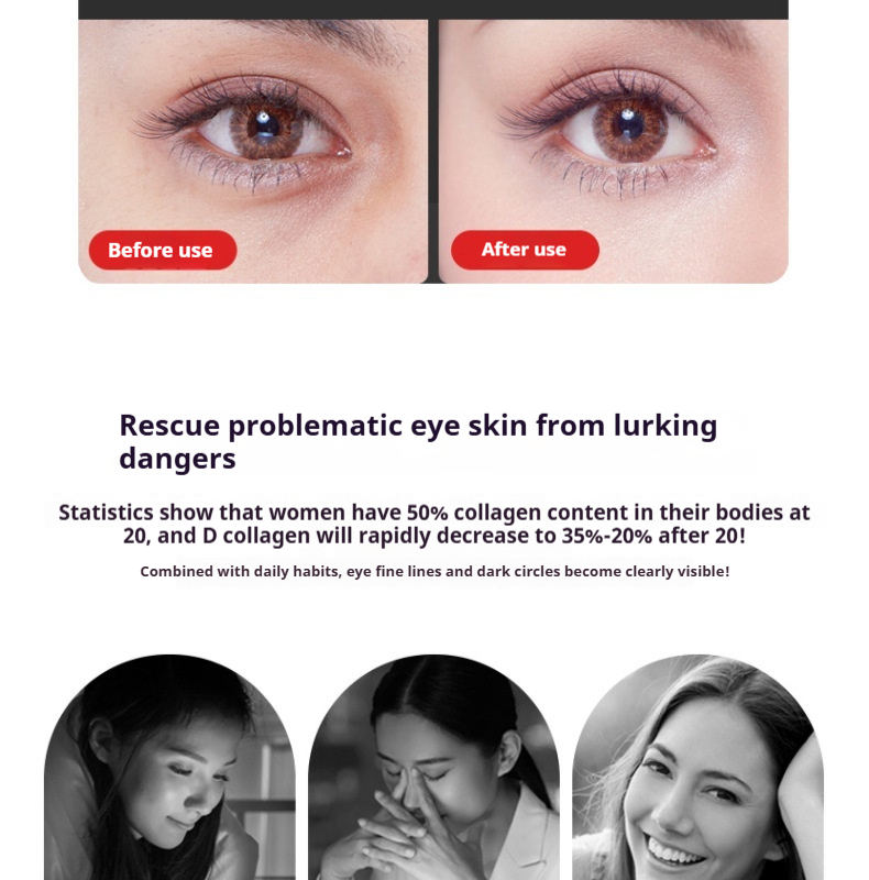 Magic Eye RF Eye Massager - Anti-Aging Eye Care Device for Removing Dark Circles & Puffy Bags, At-Home Facial Lifting Equipment-Lumenessence