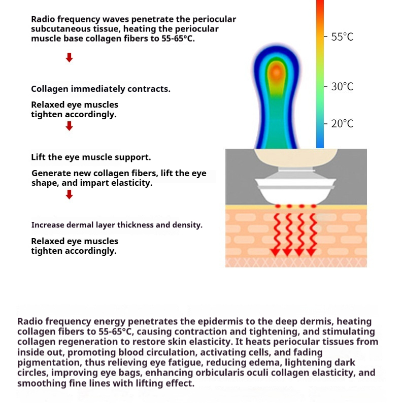 Magic Eye RF Eye Massager - Anti-Aging Eye Care Device for Removing Dark Circles & Puffy Bags, At-Home Facial Lifting Equipment-Lumenessence