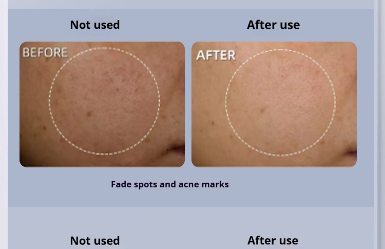 Microcurrent Facial Device - Lifting, Firming & Anti-Aging with Nano-Ion Infusion