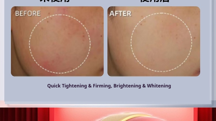 Microcurrent Facial Device - Lifting, Firming & Anti-Aging with Nano-Ion Infusion