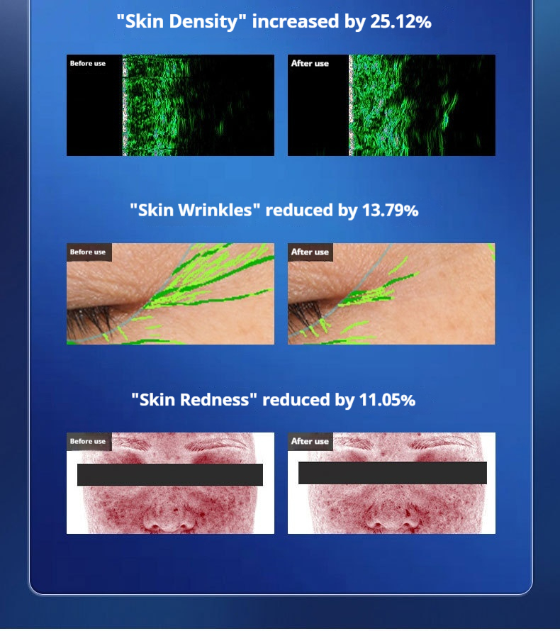 Professional LED Light Therapy Mask - Anti-Aging & Skin Tightening Facial Device for Rejuvenation and Radiance-Lumenessence