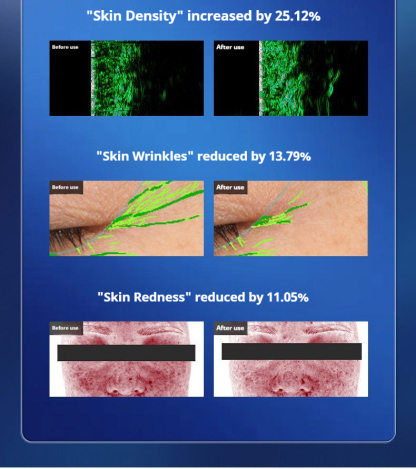 Professional LED Light Therapy Mask - Anti-Aging & Skin Tightening Facial Device for Rejuvenation and Radiance