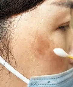 🥳🥳This is amazing! After just one use, my skin becomes so soft and bright.  🌸This is the latest whitening and spot-removing serum