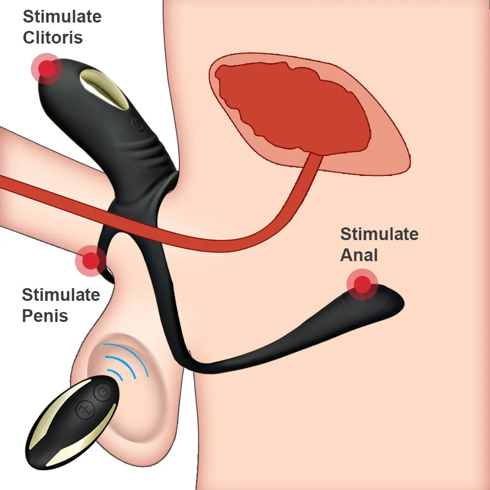 Dual-Function Penis Ring for Delayed Ejaculation and Intense Orgasms-IntimiLife