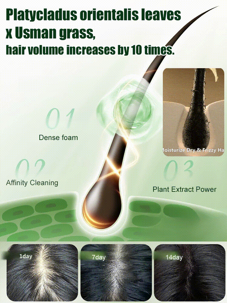 【🔥Buy 1 Get 1 Free】🌿Thuja Leaf Anti-Hair Loss Shampoo Bar 🧼 | Get two boxes for only $39! A family's battle to protect hair volume!