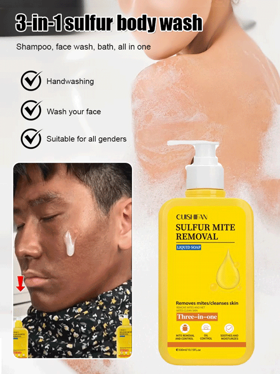 🧴3-in-1 Sulfur Anti-Mite Body Wash | 50% Off! Shampoo, face wash, and body wash all in one bottle!✨