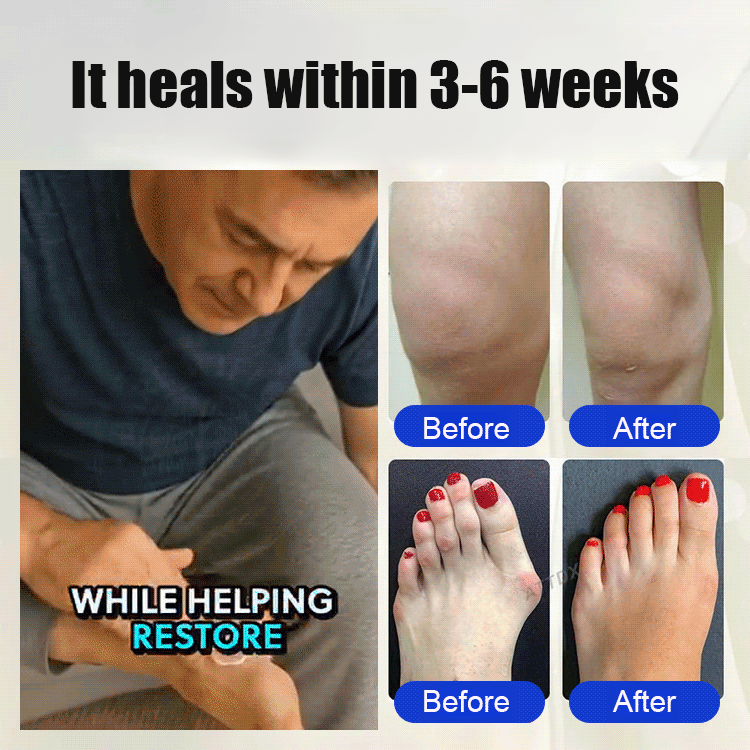 🦶 Foot Nerve Care Cream｜⚡ 3x Penetration, Deep Soothing, Fast Results