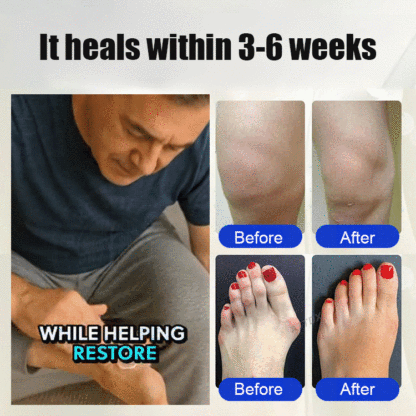 🦶 Foot Nerve Care Cream｜⚡ 3x Penetration, Deep Soothing, Fast Results