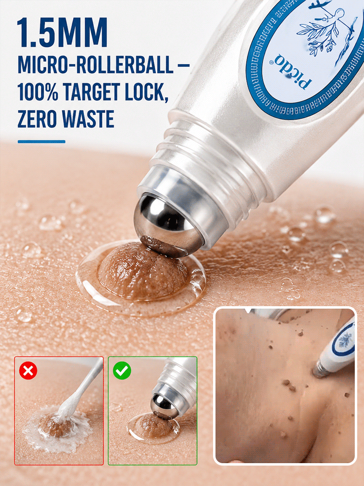 【Buy 1 Get 1 Free for a Limited Time!】[Painless and Precise Removal of Warts] Skin Repair Pen that Removes Warts with a Roll，Suitable for both men and women, proven effective!