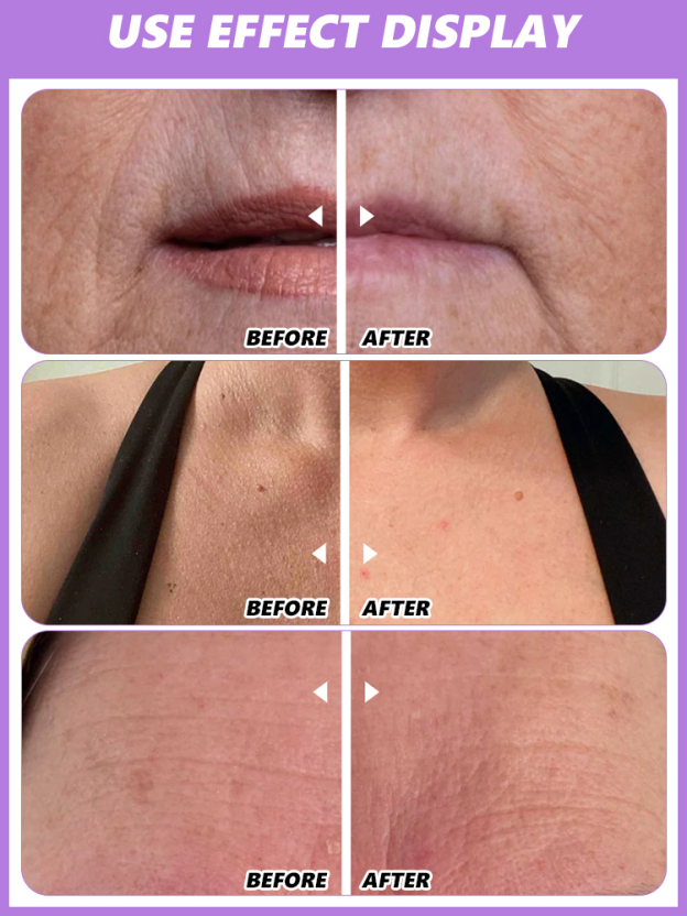 [Gently smooth out wrinkles] Anti-Wrinkle Calcium Balm【Buy 1 Get 1 Free for a Limited Time】