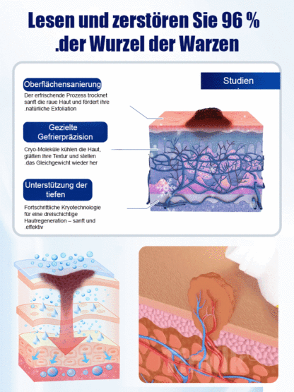 Kühlspray für angenehme Frische