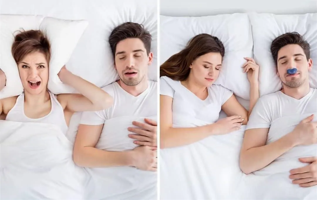 🔥Last Day 49% OFF-The First Hoseless, Maskless, Micro-CPAP Anti Snoring