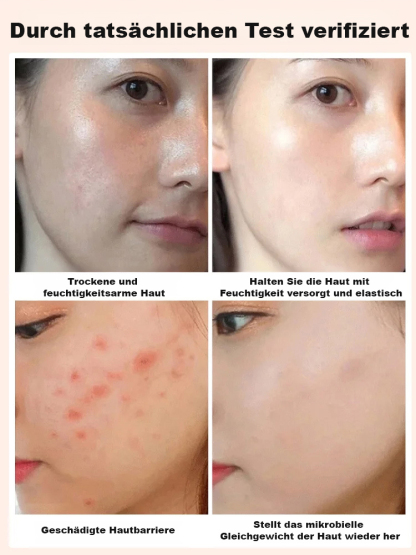 【Kein Zucker oder Öl】Feigen-Walnuss-Sesam Nährkuchen ✨ 17kg Feigen = 1kg Premium ✨ Zartschmelzend für Jung & Alt