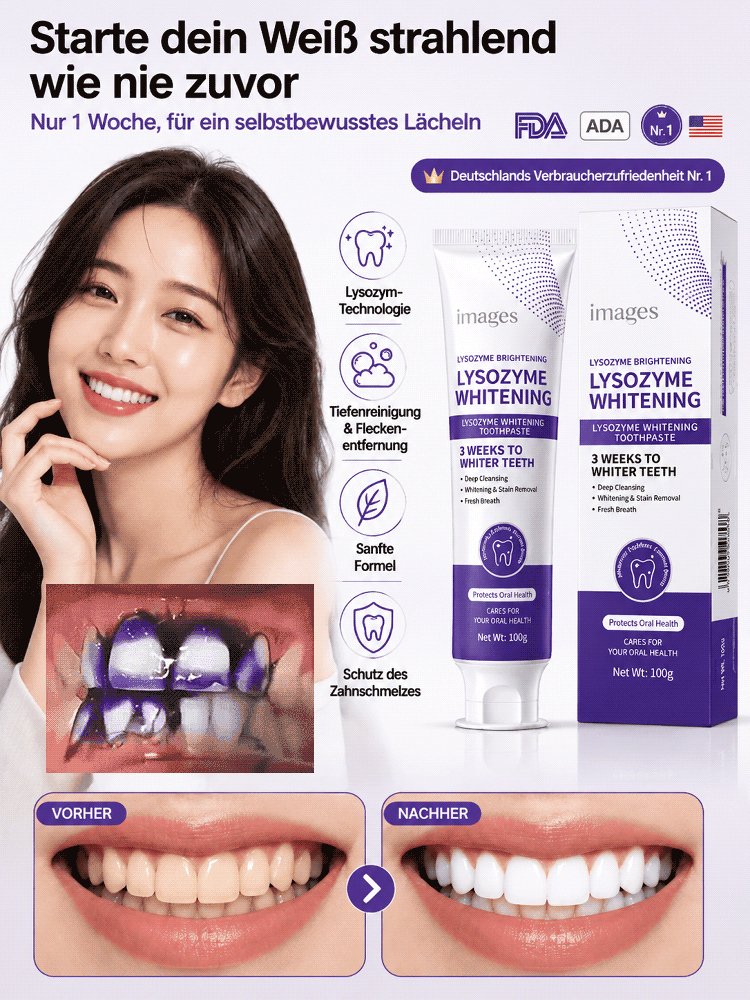 Stern-Diamant Nano Whitening Zahnpasta