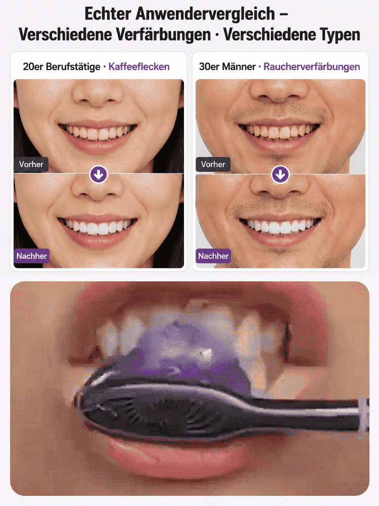 Stern-Diamant Nano Whitening Zahnpasta